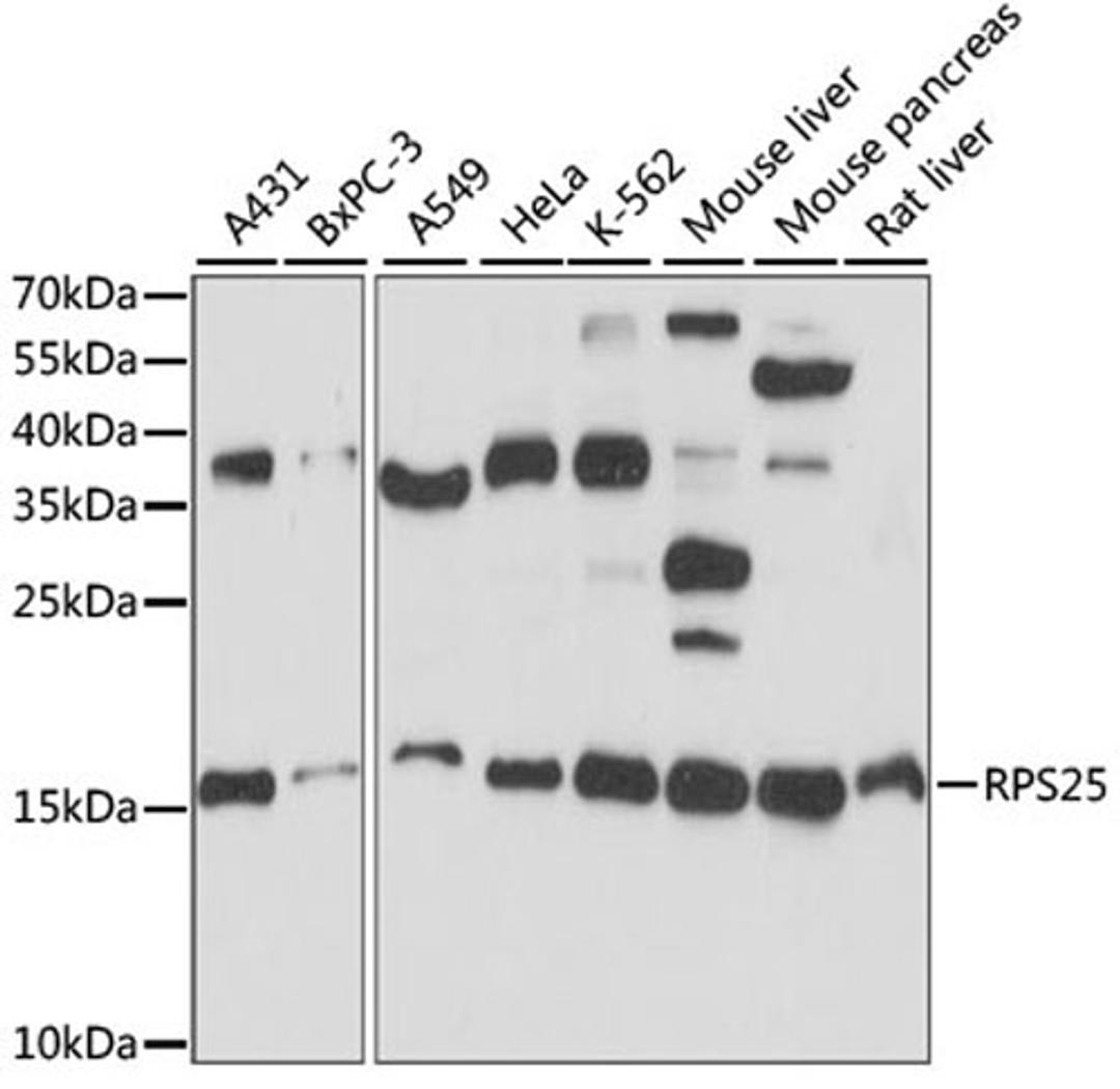 Western blot - RPS25 antibody (A15314)