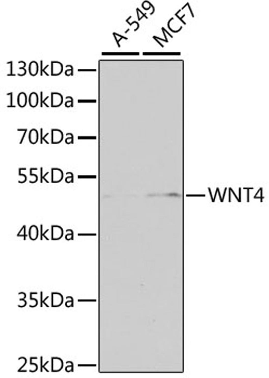 Western blot - WNT4 antibody (A7809)