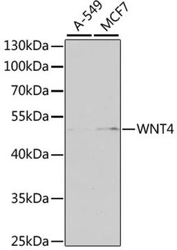 Western blot - WNT4 antibody (A7809)