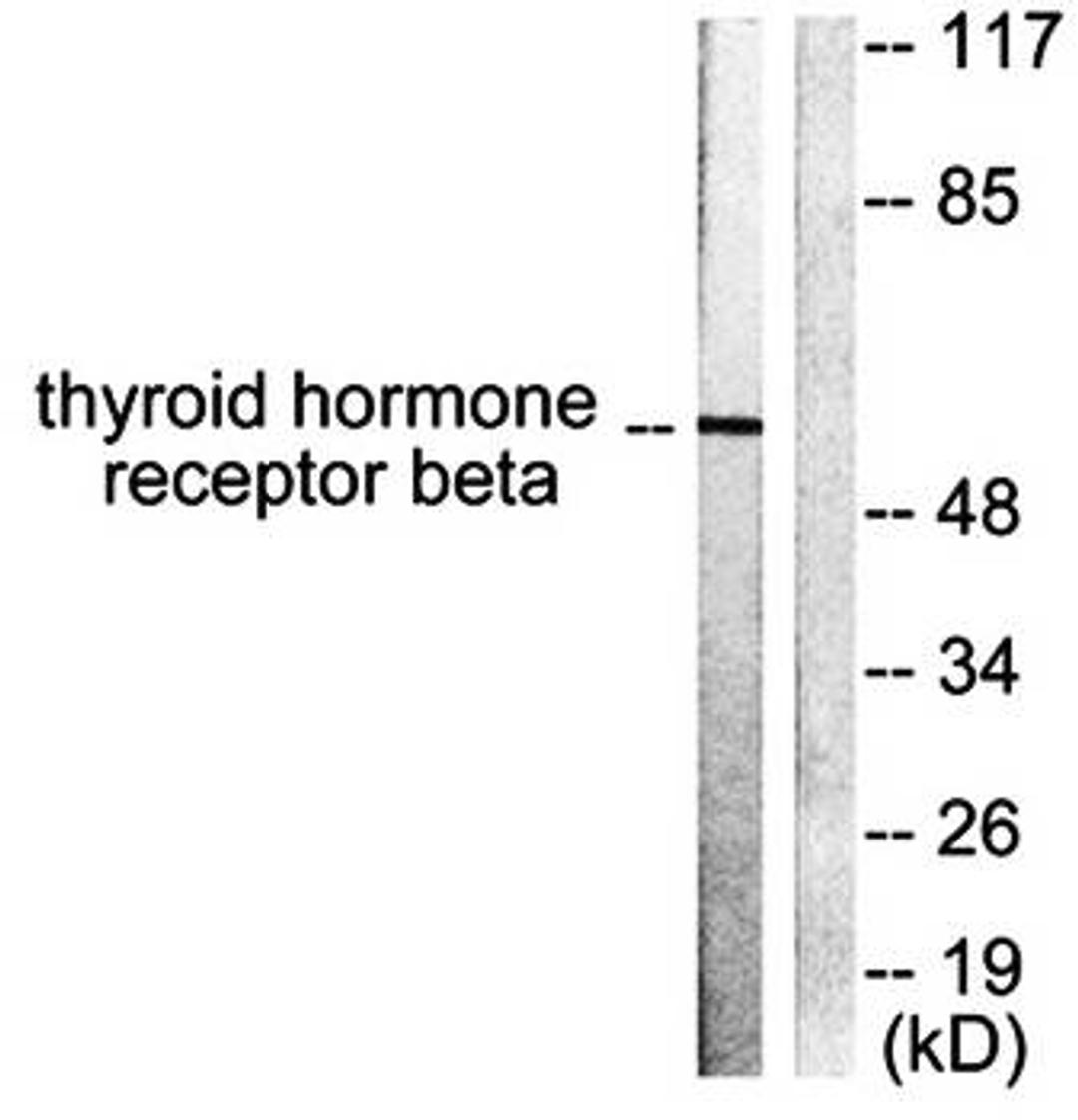 Western blot analysis of extracts from LOVO cells using Thyroid Hormone Receptor beta antibody