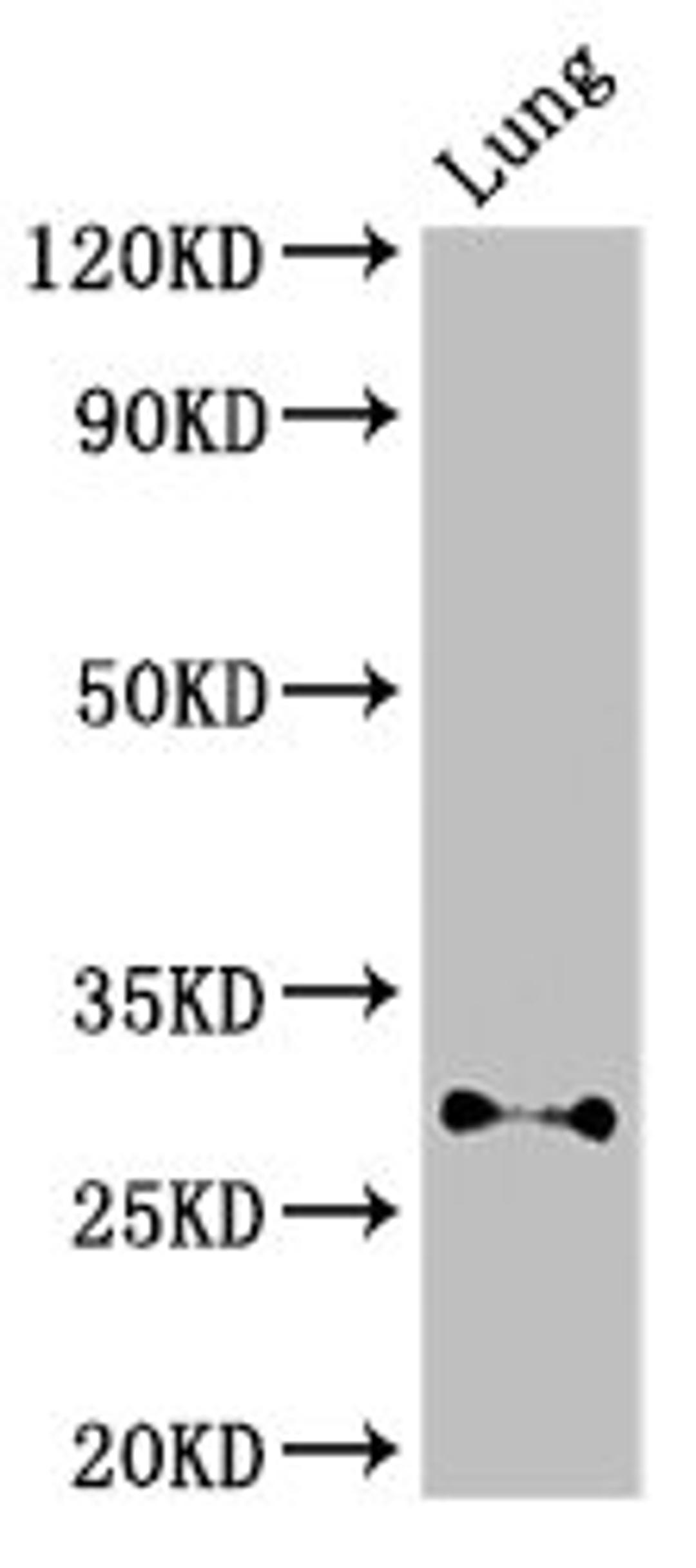 Western Blot. Positive WB detected in: Mouse lung tissue. All lanes: SPINT2 antibody at 3ug/ml. Secondary. Goat polyclonal to rabbit IgG at 1/50000 dilution. Predicted band size: 29, 22 kDa. Observed band size: 29 kDa.