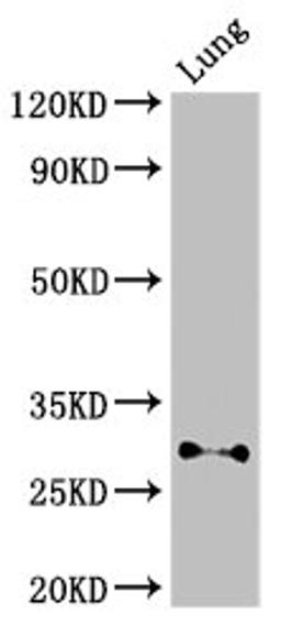 Western Blot. Positive WB detected in: Mouse lung tissue. All lanes: SPINT2 antibody at 3ug/ml. Secondary. Goat polyclonal to rabbit IgG at 1/50000 dilution. Predicted band size: 29, 22 kDa. Observed band size: 29 kDa.