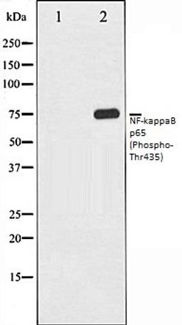 Western blot analysis of COS7 whole cell lysates using NF- kappaB p65 (Phospho-Thr435) antibody, The lane on the left is treated with the antigen-specific peptide.