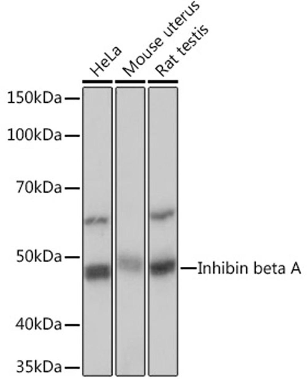 Western blot - Inhibin beta A Rabbit mAb (A5232)