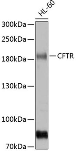 Western blot - CFTR antibody (A8386)