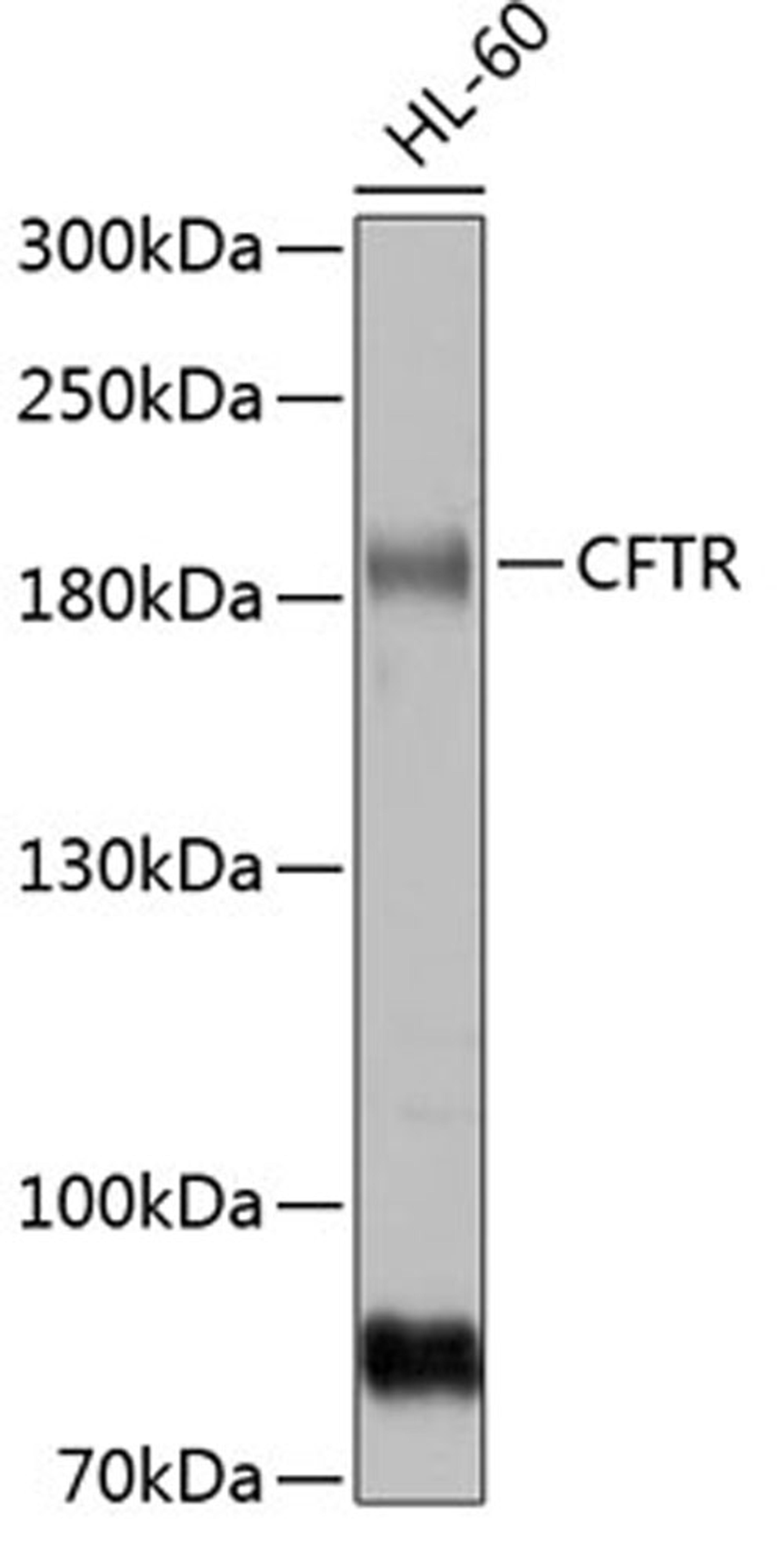 Western blot - CFTR antibody (A8386)