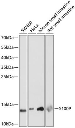 Western blot - S100P antibody (A14780)