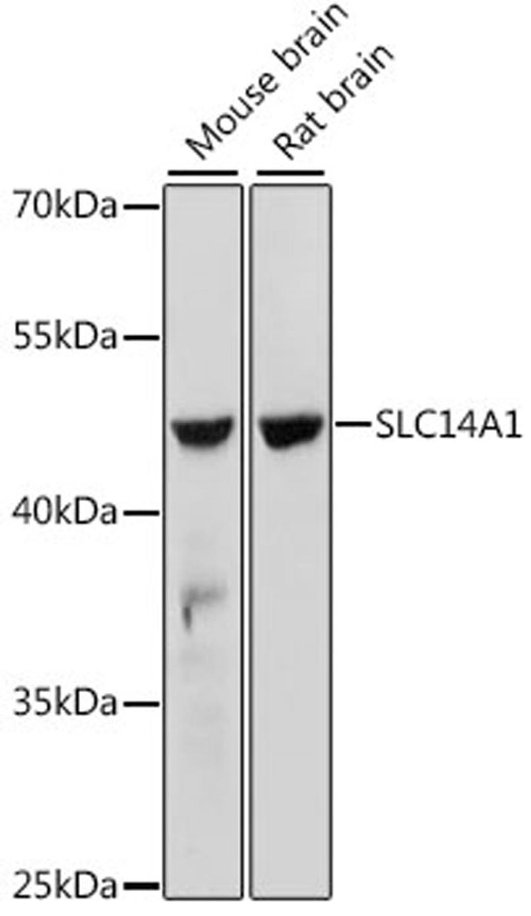 Western blot - SLC14A1 antibody (A15991)