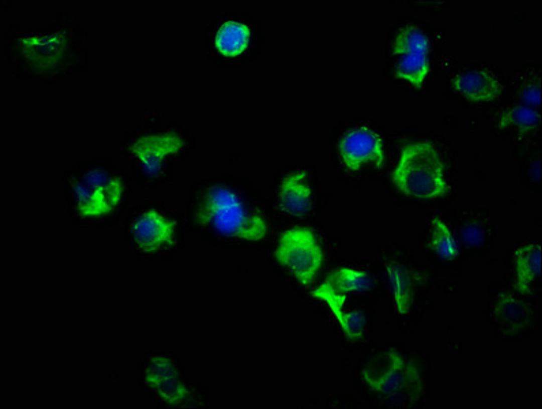 Immunofluorescence staining of MCF-7 cells with CSB-PA008734LA01HU at 1:266, counter-stained with DAPI. The cells were fixed in 4% formaldehyde, permeabilized using 0.2% Triton X-100 and blocked in 10% normal Goat Serum. The cells were then incubated with the antibody overnight at 4&deg;C. The secondary antibody was Alexa Fluor 488-congugated AffiniPure Goat Anti-Rabbit IgG(H+L).