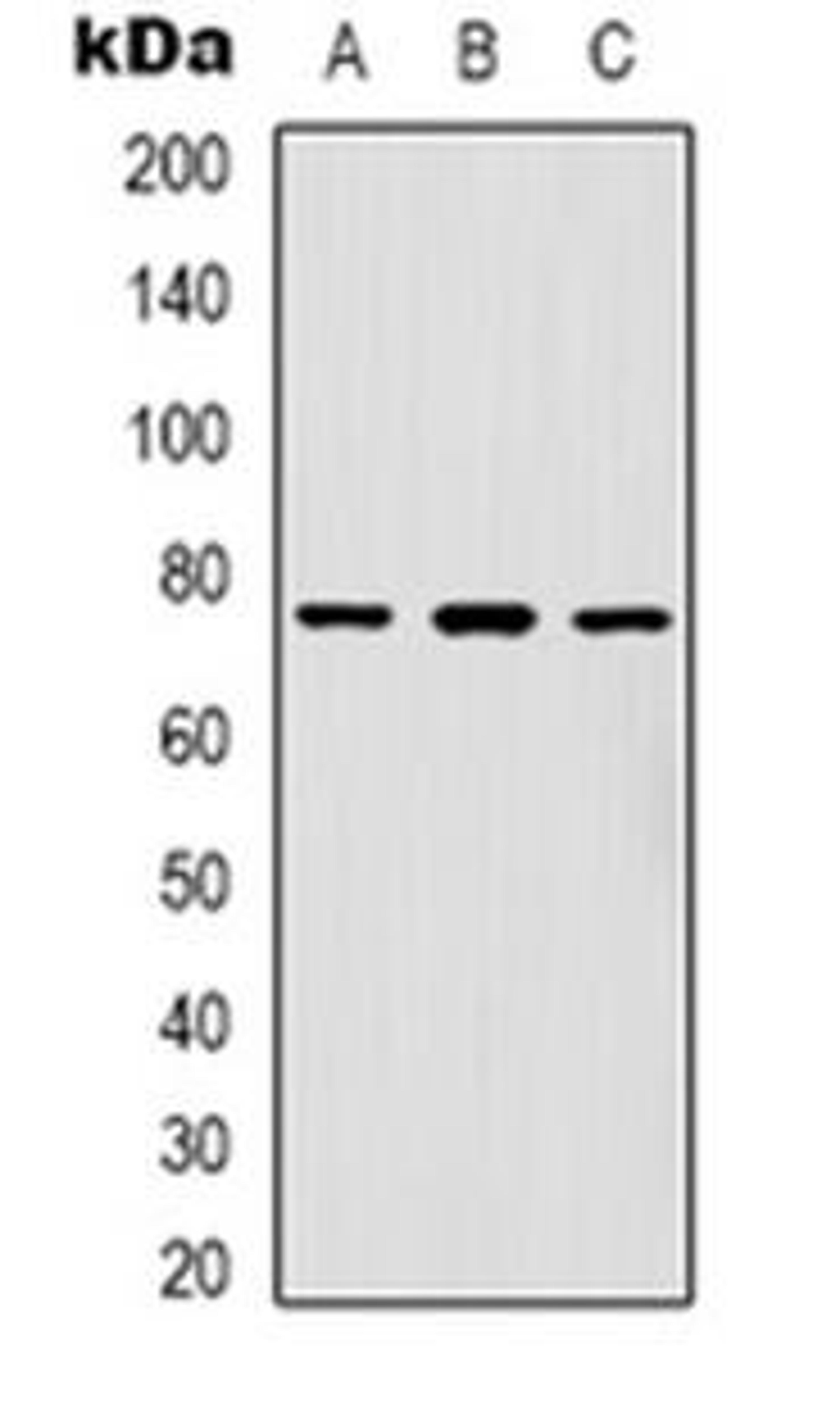 Western blot analysis of FOXK1 expression in Hela (Lane 1), A431 (Lane 2), Jurkat (Lane 3) whole cell lysates using FOXK1 antibody