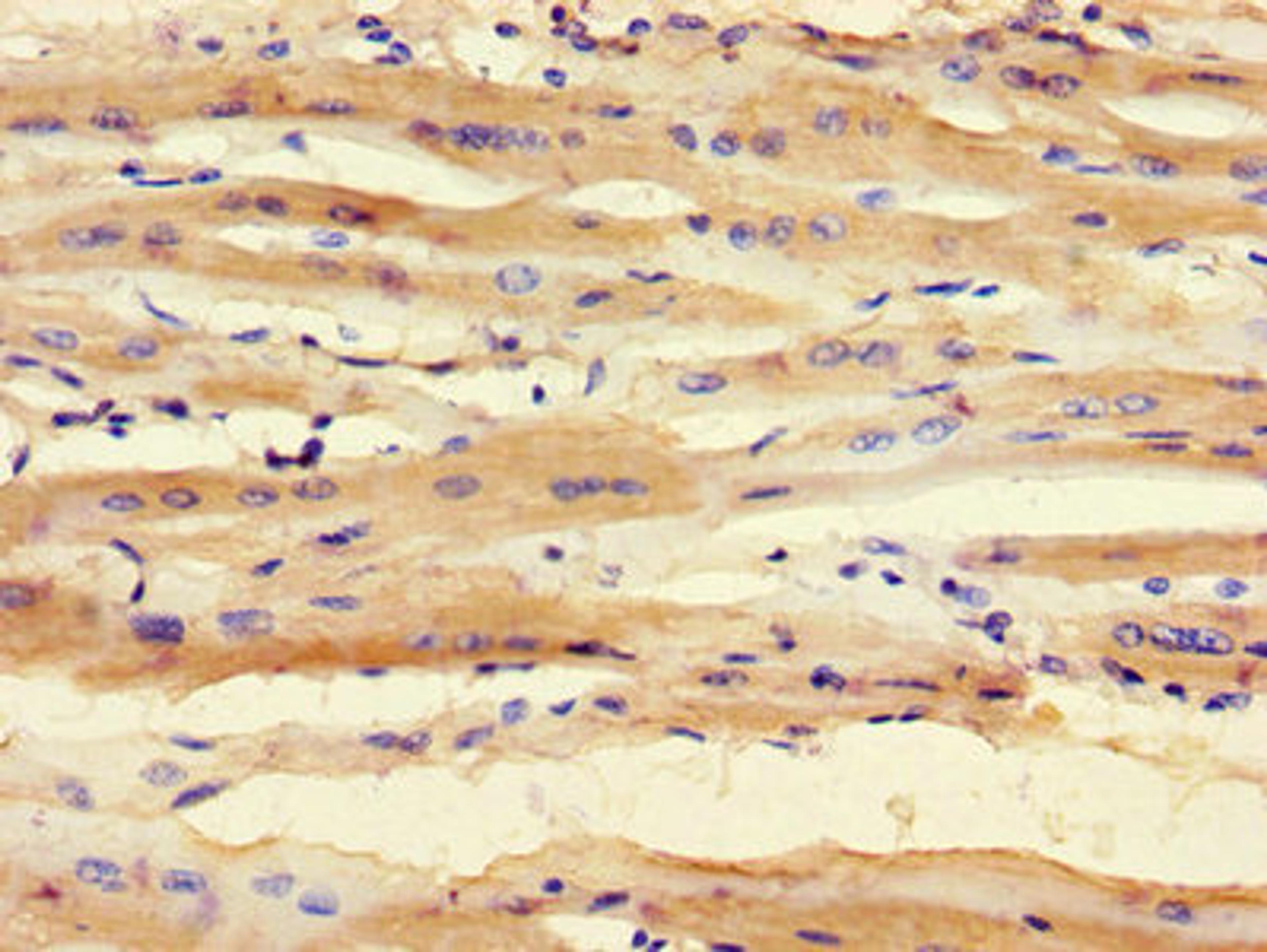 Immunohistochemistry of paraffin-embedded human heart tissue using CSB-PA021840LA01HU at dilution of 1:100