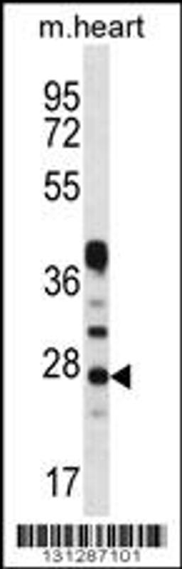 Western blot analysis in mouse heart tissue lysates (35ug/lane).