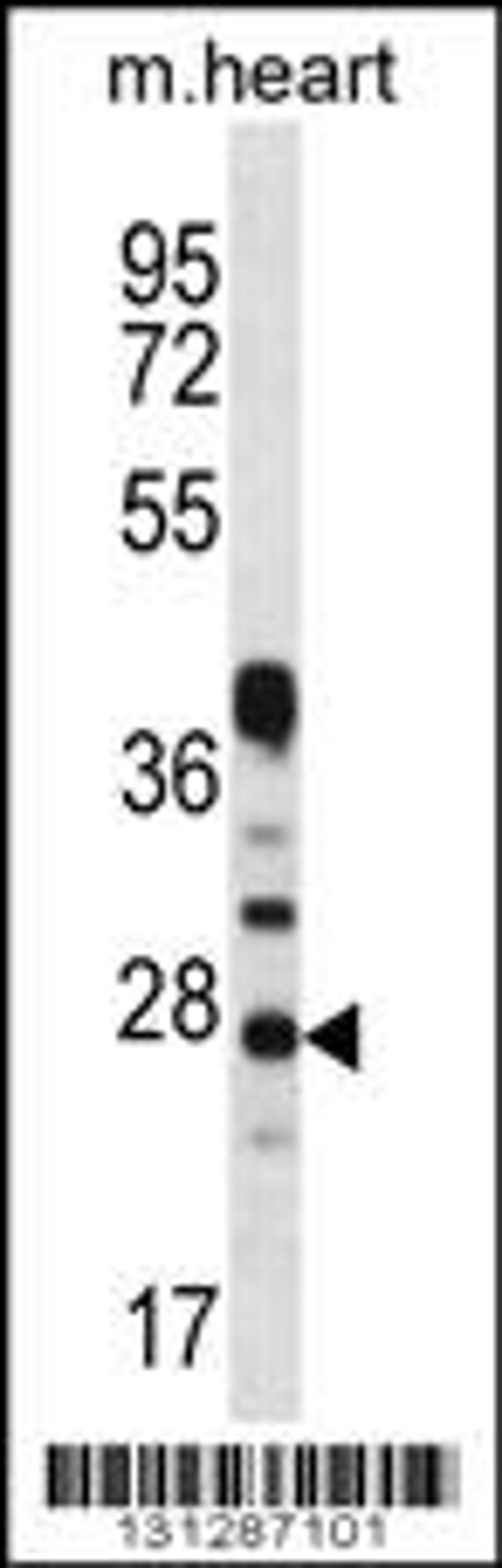 Western blot analysis in mouse heart tissue lysates (35ug/lane).