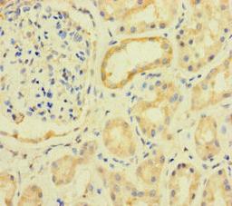 Immunohistochemistry of paraffin-embedded human kidney tissue using CSB-PA805325LA01HU at dilution of 1:100