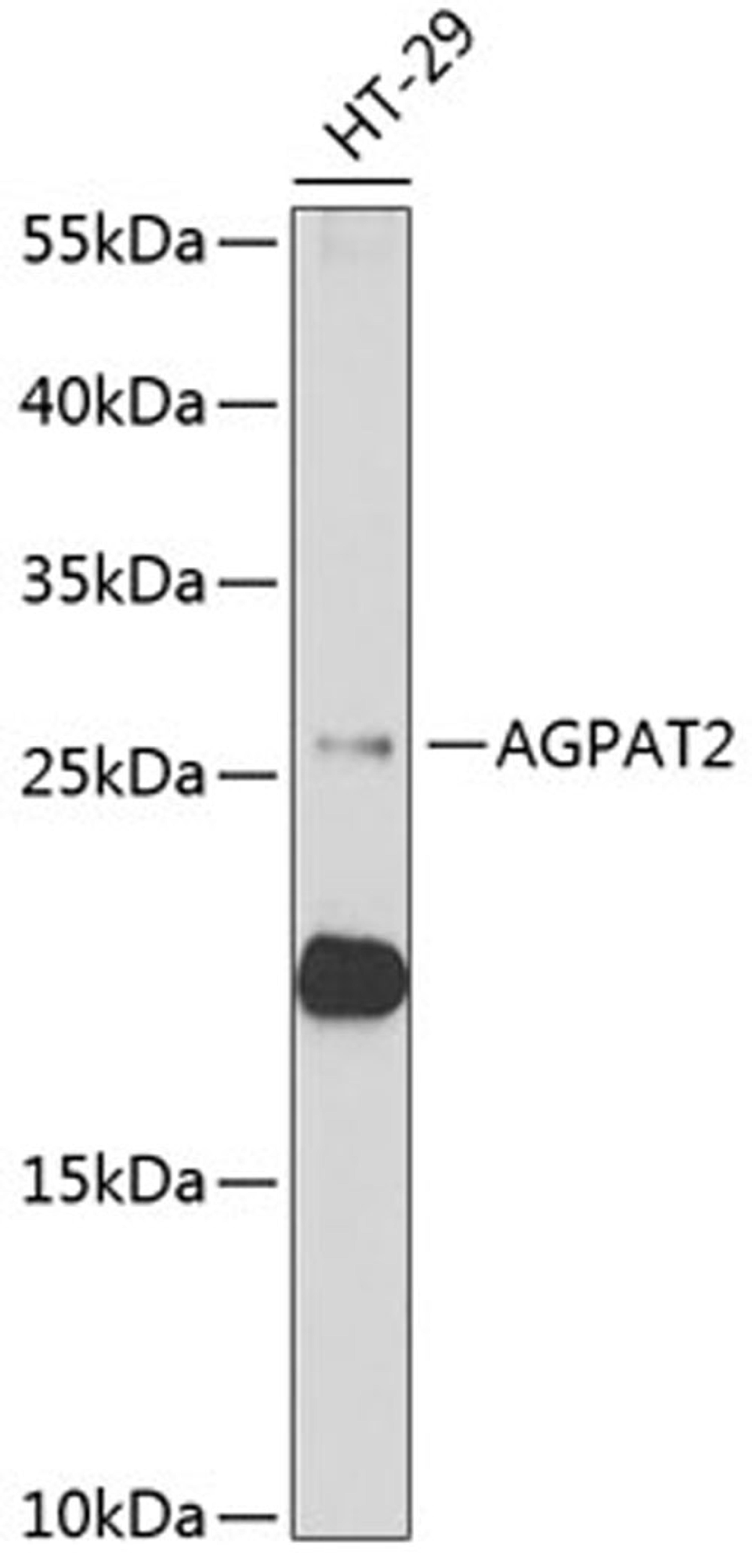 Western blot - AGPAT2 antibody (A6518)