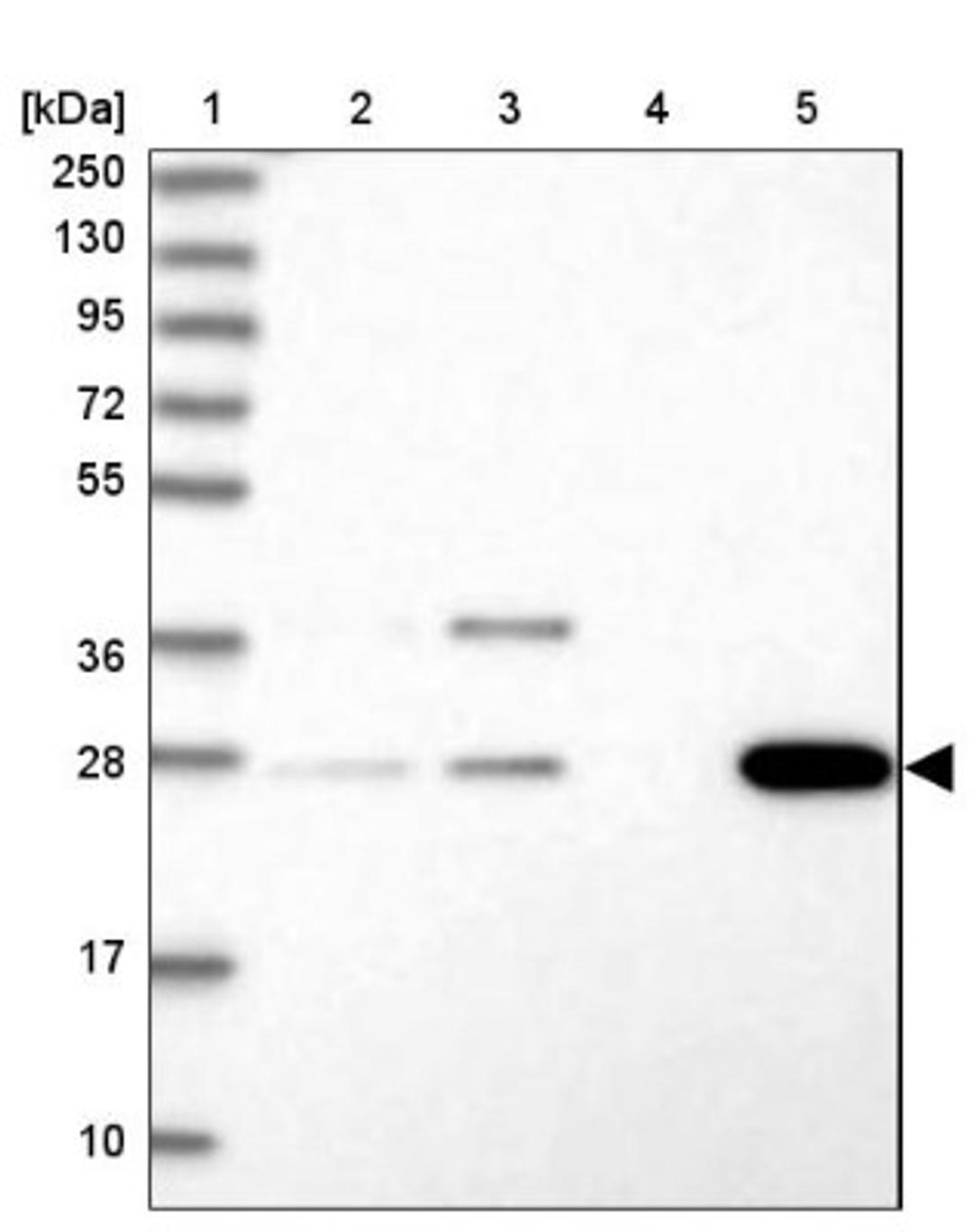 Western Blot: FRG2B Antibody [NBP2-32633] - Lane 1: Marker [kDa] 250, 130, 95, 72, 55, 36, 28, 17, 10<br/>Lane 2: Human cell line RT-4<br/>Lane 3: Human cell line U-251MG sp<br/>Lane 4: Human plasma (IgG/HSA depleted)<br/>Lane 5: Human liver tissue