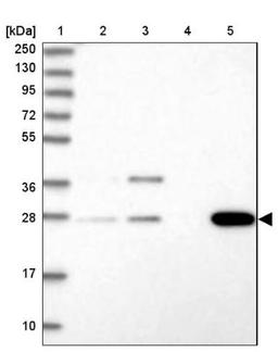 Western Blot: FRG2B Antibody [NBP2-32633] - Lane 1: Marker [kDa] 250, 130, 95, 72, 55, 36, 28, 17, 10<br/>Lane 2: Human cell line RT-4<br/>Lane 3: Human cell line U-251MG sp<br/>Lane 4: Human plasma (IgG/HSA depleted)<br/>Lane 5: Human liver tissue