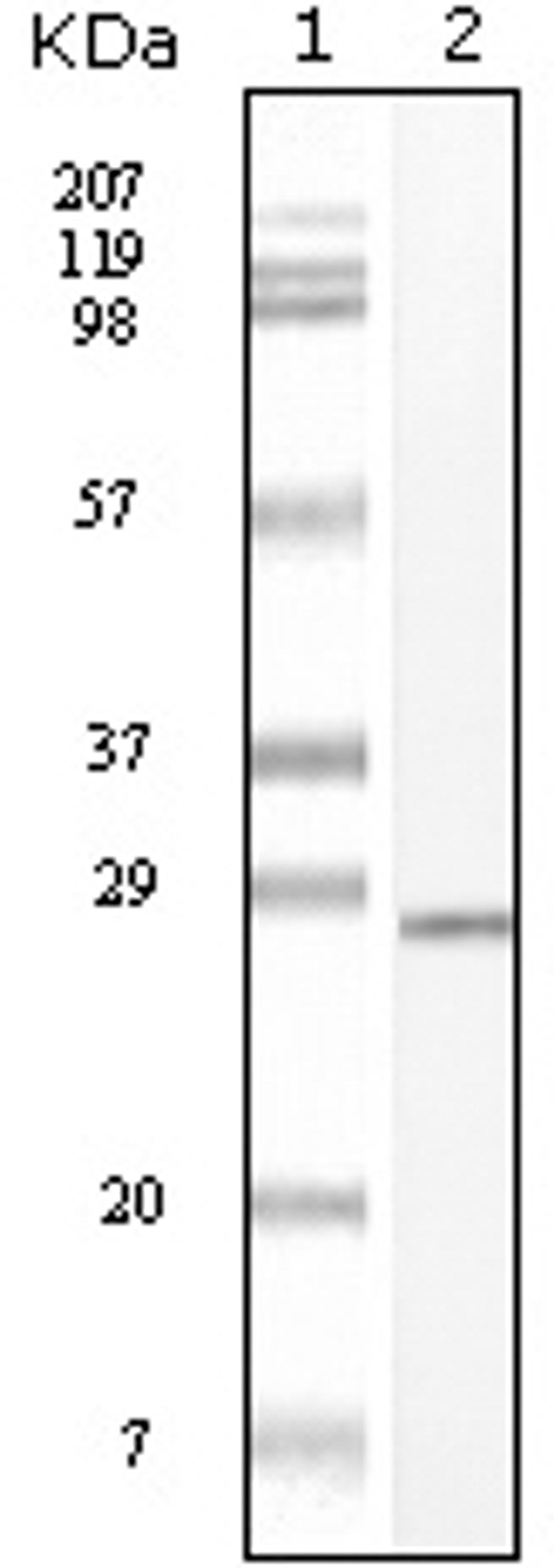 Western blot analysis using C - kit monoclonal antibody against truncated C - kit recombinant protein