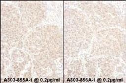 Detection of human PSMD4 by immunohistochemistry.