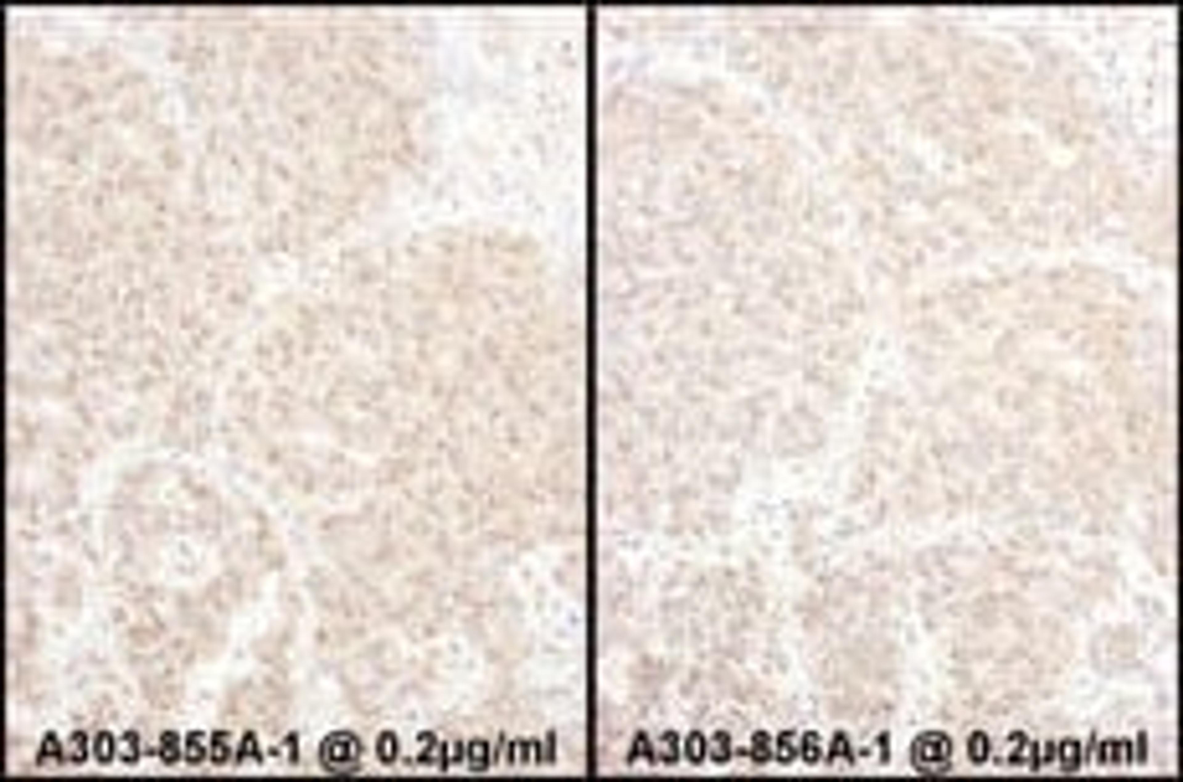 Detection of human PSMD4 by immunohistochemistry.