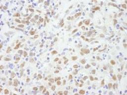 Detection of human CBX5 by immunohistochemistry.