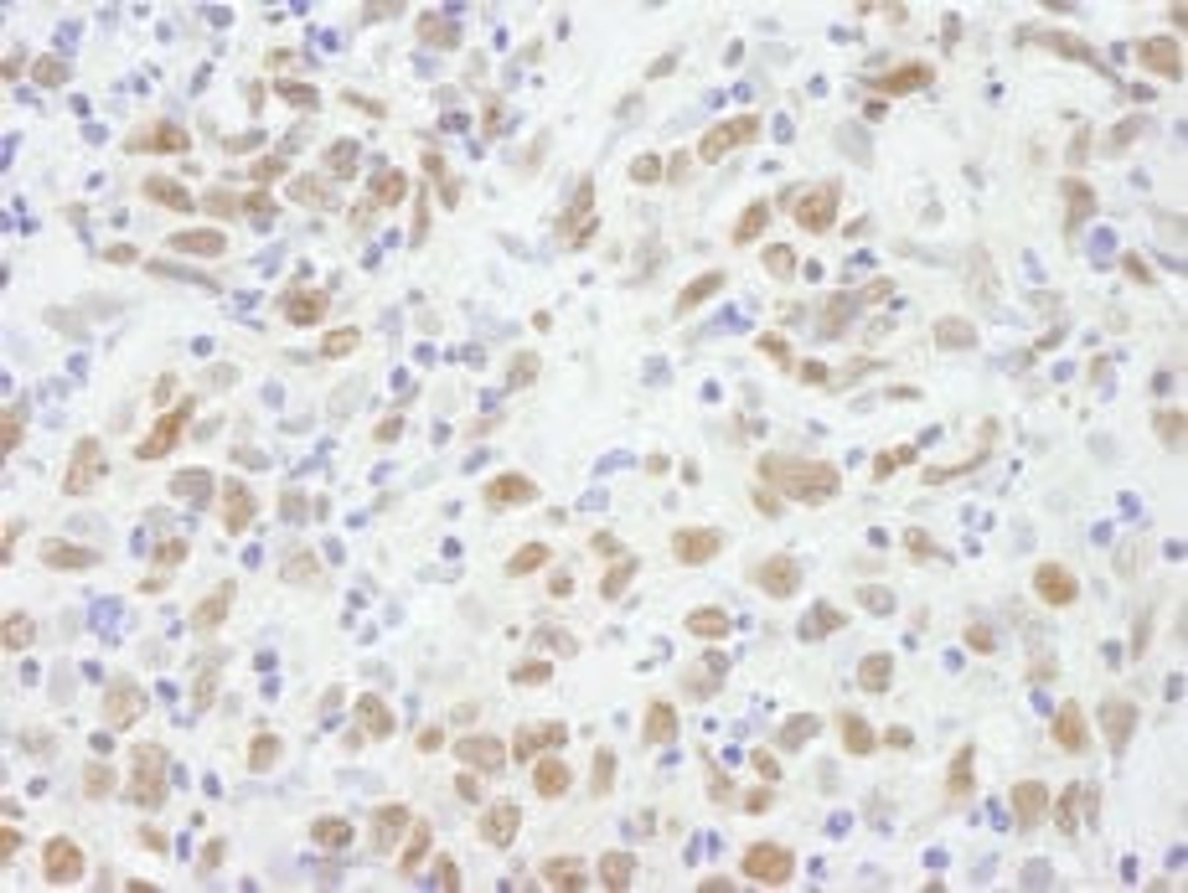 Detection of human CBX5 by immunohistochemistry.