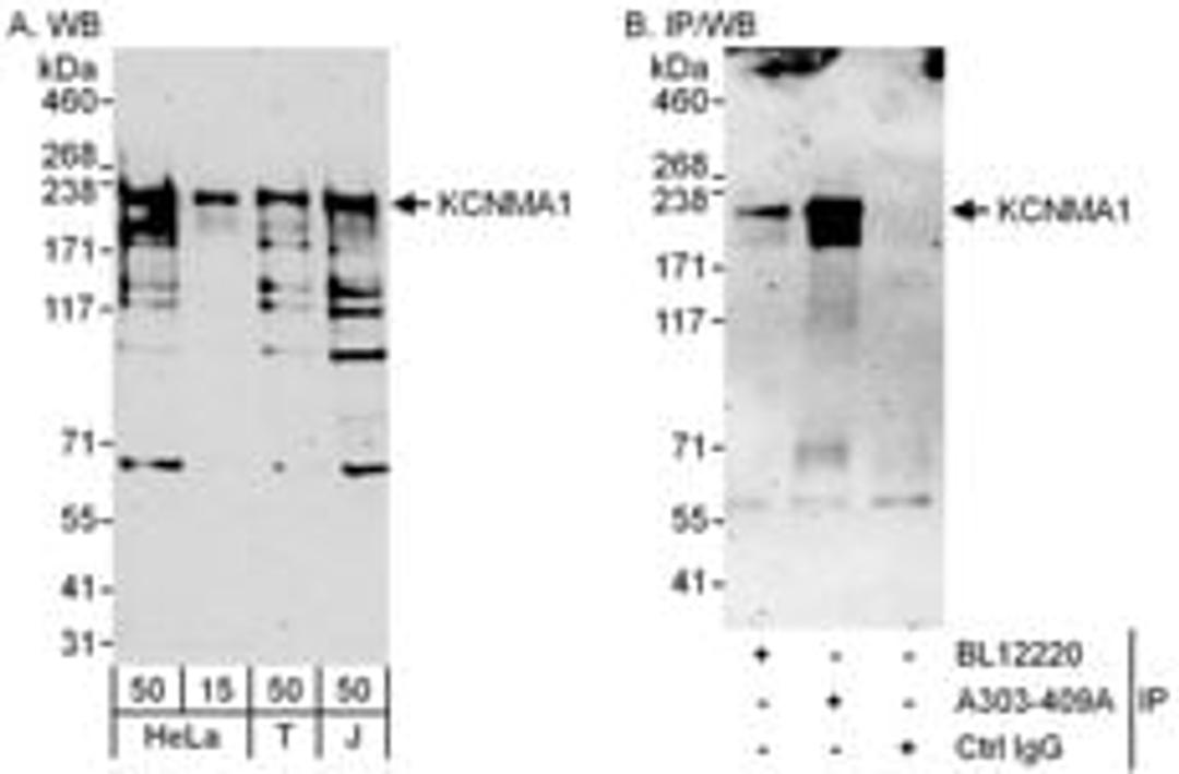 Detection of human KCNMA1 by western blot and immunoprecipitation.