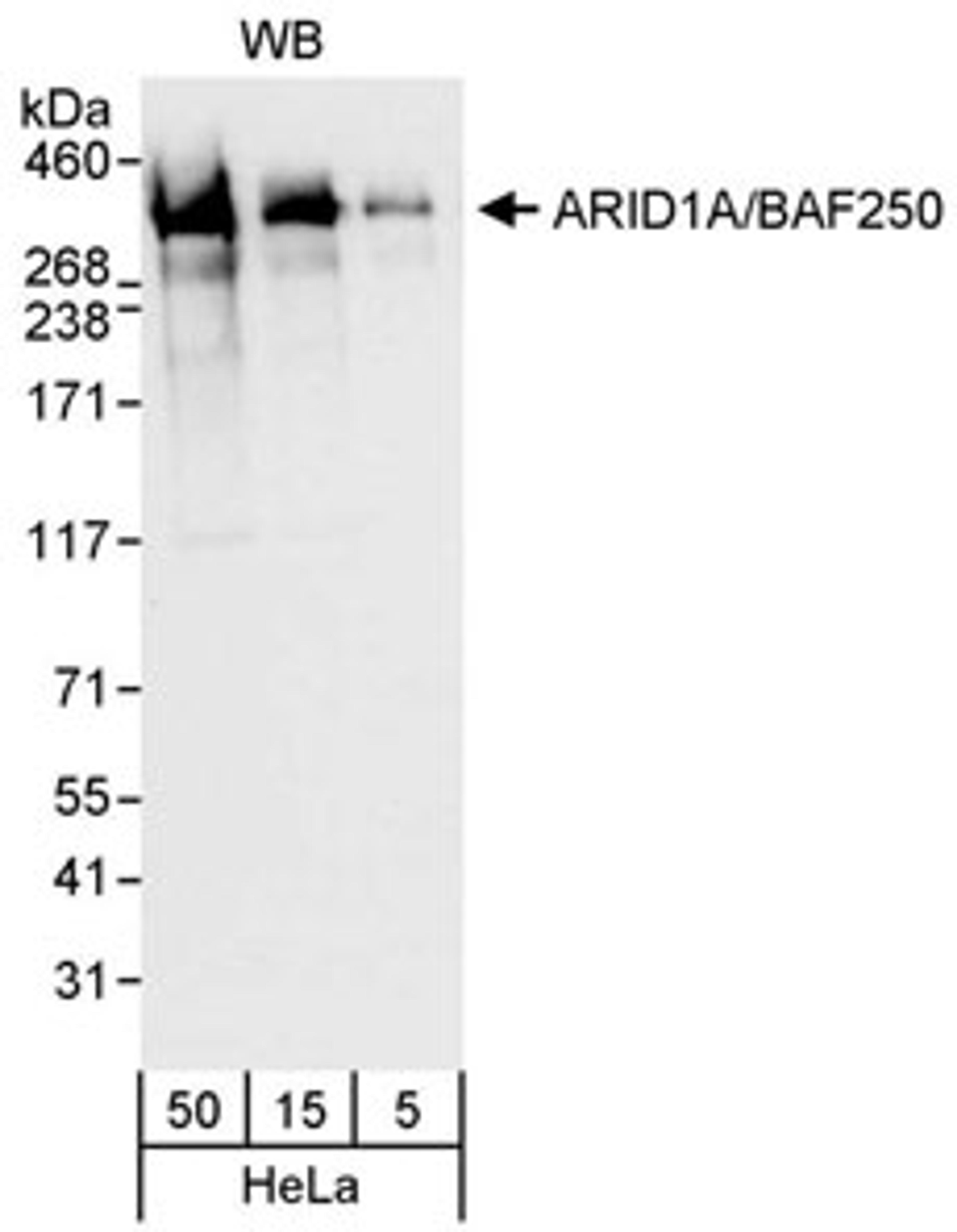 Detection of human ARID1A by western blot.