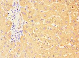 Immunohistochemistry of paraffin-embedded human liver tissue using CSB-PA873720LA01HU at dilution of 1:100