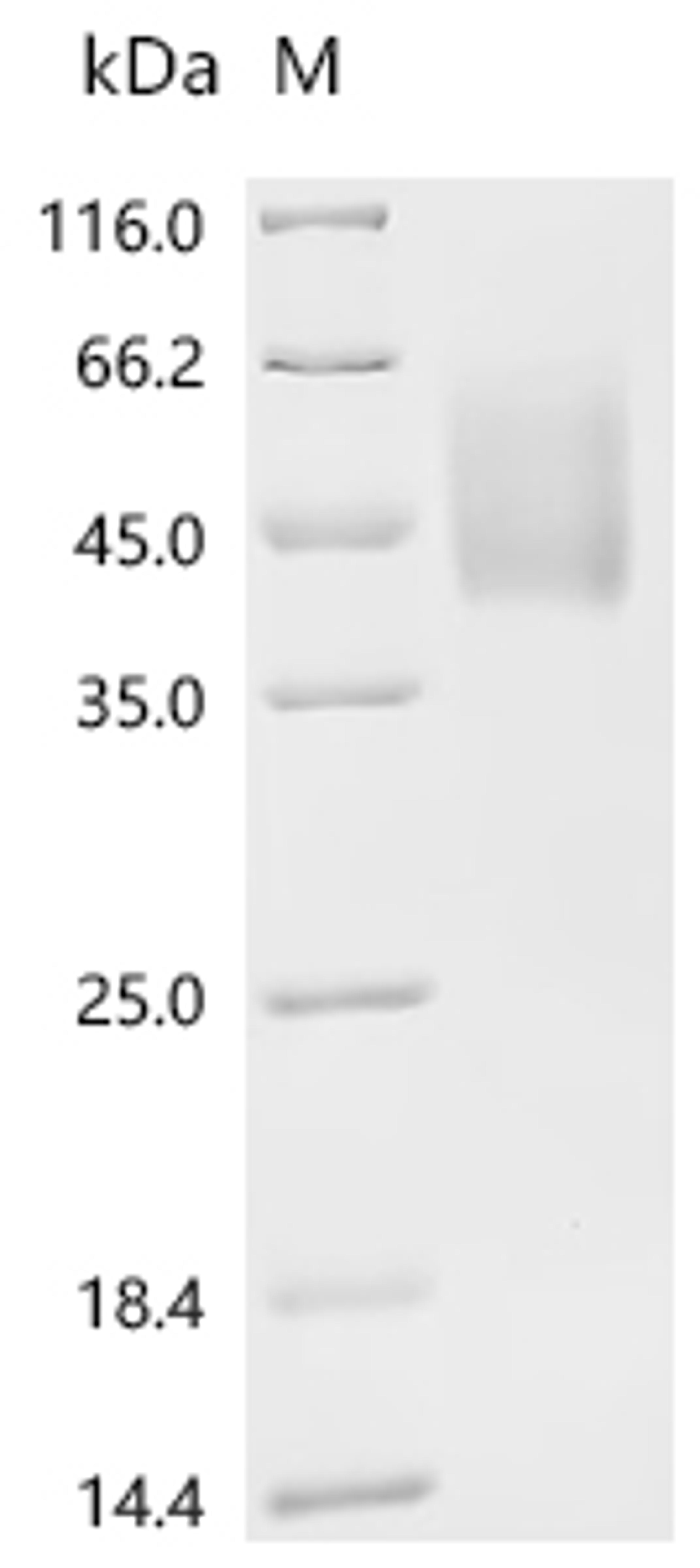 (Tris-Glycine gel) Discontinuous SDS-PAGE (reduced) with 5% enrichment gel and 15% separation gel.