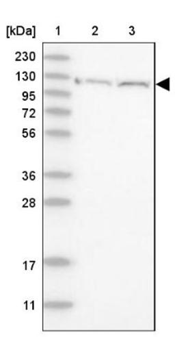 Western Blot: Myosin 1C Antibody [NBP1-87745] - Lane 1: Marker [kDa] 230, 130, 95, 72, 56, 36, 28, 17, 11<br/>Lane 2: Human cell line RT-4<br/>Lane 3: Human cell line U-251MG sp