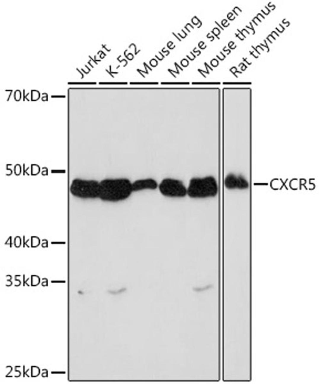 Western blot - CXCR5 Rabbit mAb (A8950)