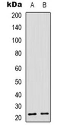 Western blot analysis of Recoverin expression in Y79 (Lane 1), NIH3T3 (Lane 2) whole cell lysates using RCVRN antibody