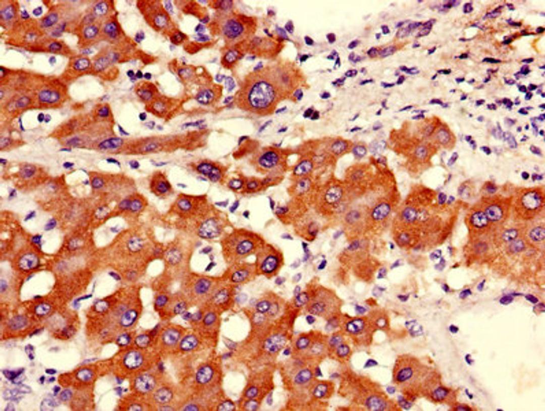 Immunohistochemistry of paraffin-embedded human liver tissue using CSB-PA002208LA01HU at dilution of 1:100