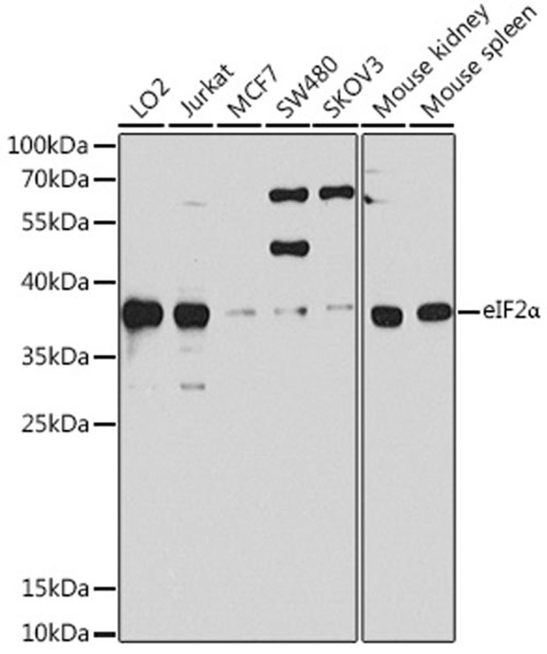 Western blot - eIF2a antibody (A0764)