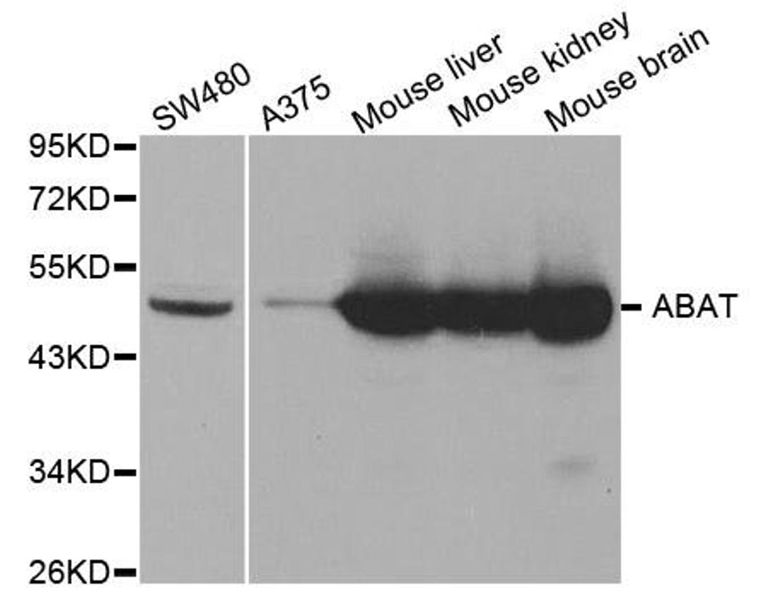 Western blot analysis of extracts of various cell lines using ABAT antibody