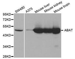 Western blot analysis of extracts of various cell lines using ABAT antibody