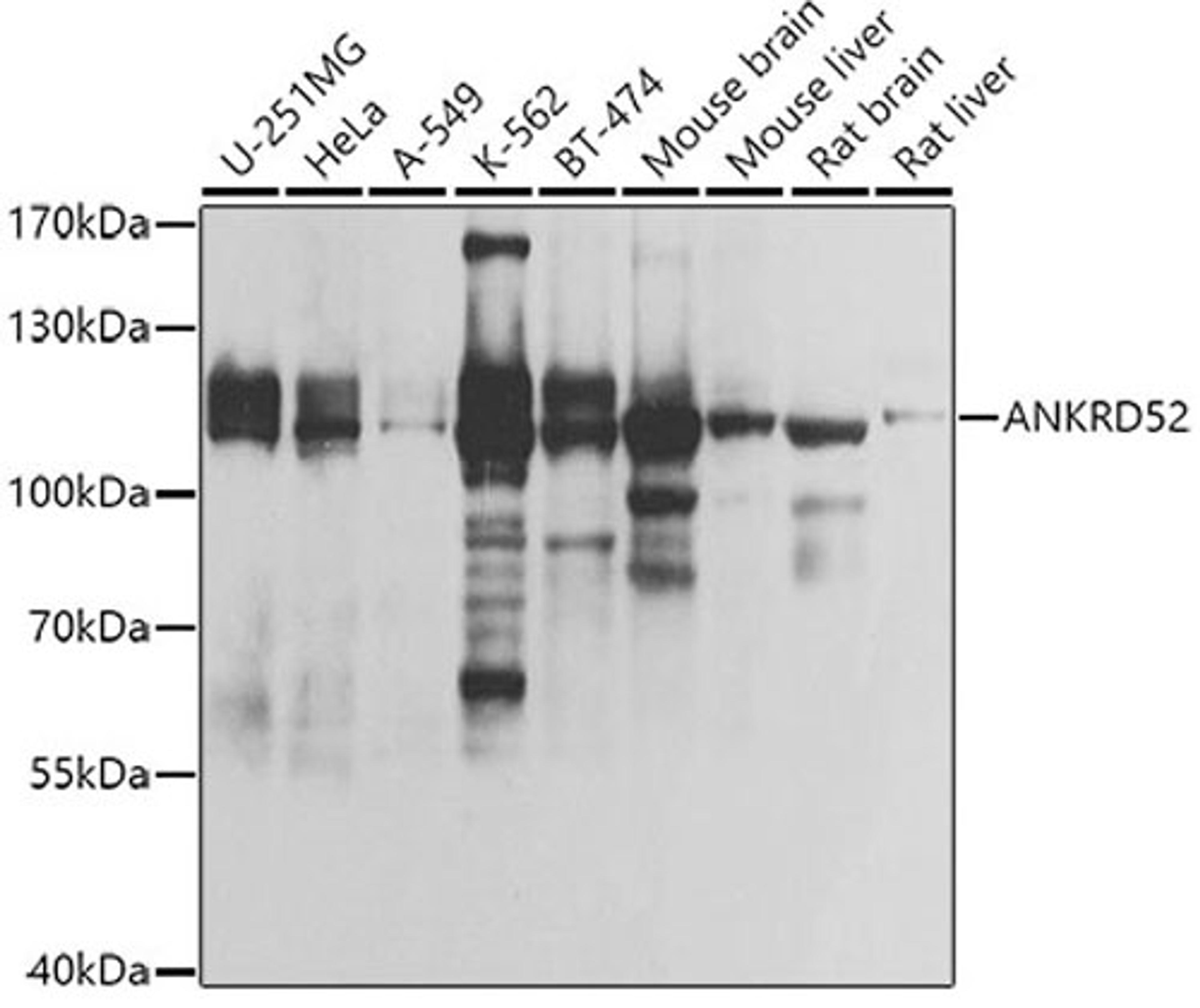 Western blot - ANKRD52 antibody (A8379)