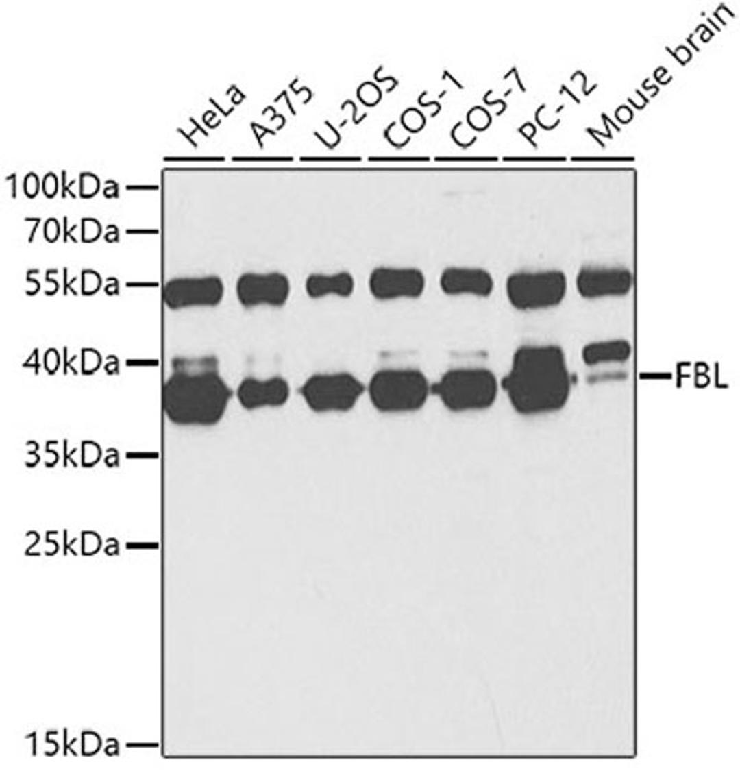 Western blot - FBL antibody (A13490)