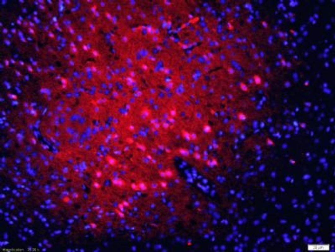 Immunohistochemical analysis of formalin-fixed paraffin embedded rat brain tissue using 5HT2A Receptor antibody (dilution at 1:200)