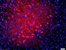 Immunohistochemical analysis of formalin-fixed paraffin embedded rat brain tissue using 5HT2A Receptor antibody (dilution at 1:200)