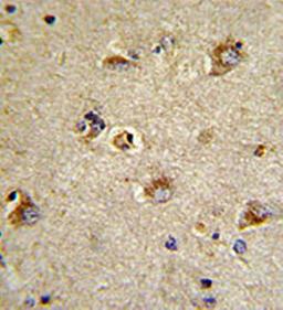 Immunohistrochemical analysis of formalin-fixed and paraffin-embedded human brain tissue using CDCA3 antibody