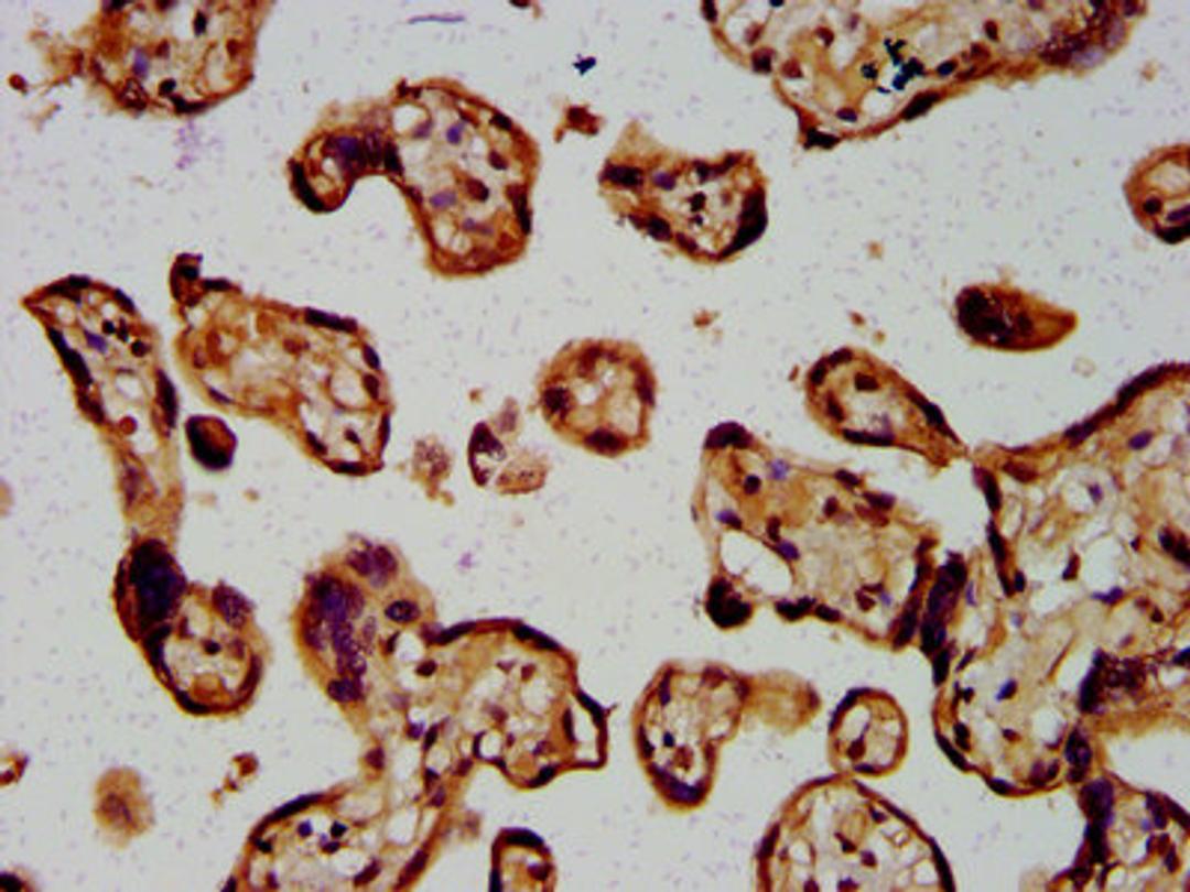 IHC image of CSB-PA850807LA01HU diluted at 1:400 and staining in paraffin-embedded human placenta tissue performed on a Leica BondTM system. After dewaxing and hydration, antigen retrieval was mediated by high pressure in a citrate buffer (pH 6.0). Section was blocked with 10% normal goat serum 30min at RT. Then primary antibody (1% BSA) was incubated at 4°C overnight. The primary is detected by a biotinylated secondary antibody and visualized using an HRP conjugated SP system.