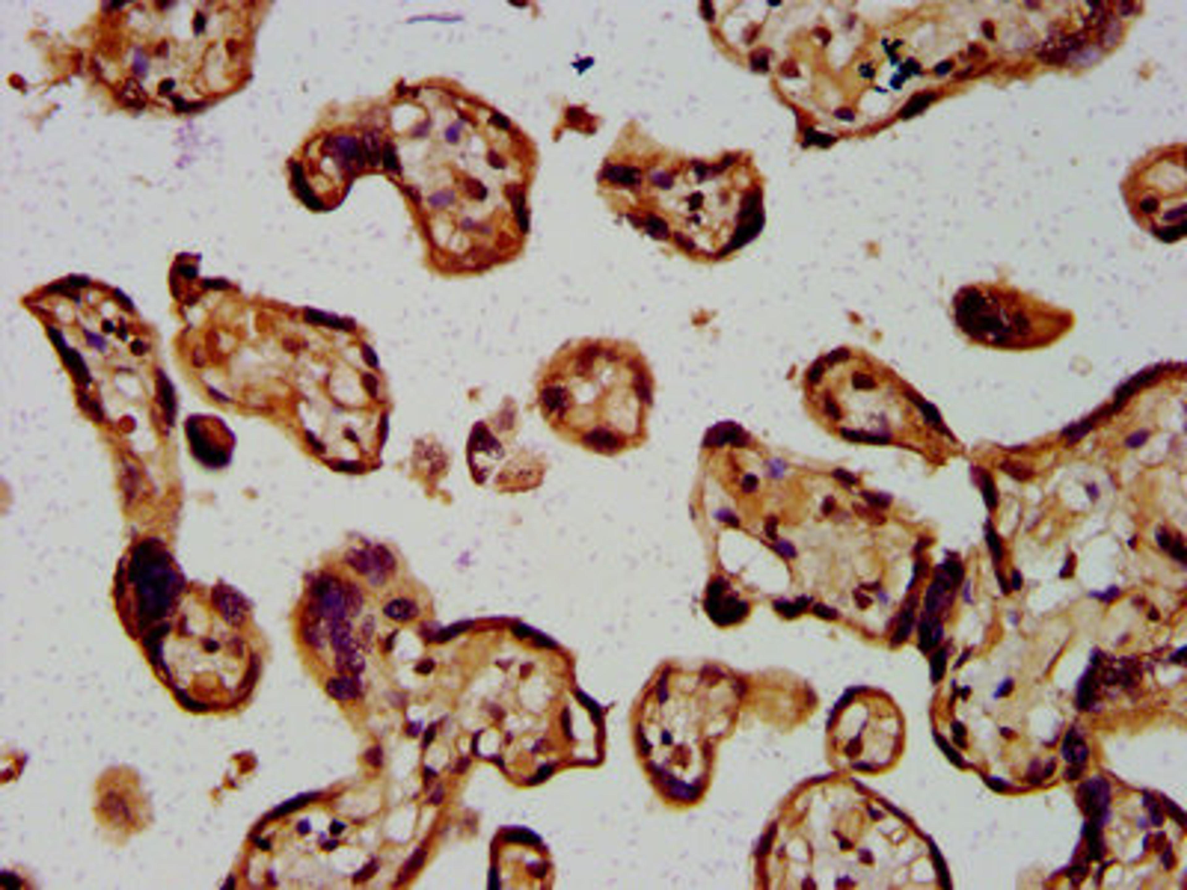 IHC image of CSB-PA850807LA01HU diluted at 1:400 and staining in paraffin-embedded human placenta tissue performed on a Leica BondTM system. After dewaxing and hydration, antigen retrieval was mediated by high pressure in a citrate buffer (pH 6.0). Section was blocked with 10% normal goat serum 30min at RT. Then primary antibody (1% BSA) was incubated at 4°C overnight. The primary is detected by a biotinylated secondary antibody and visualized using an HRP conjugated SP system.