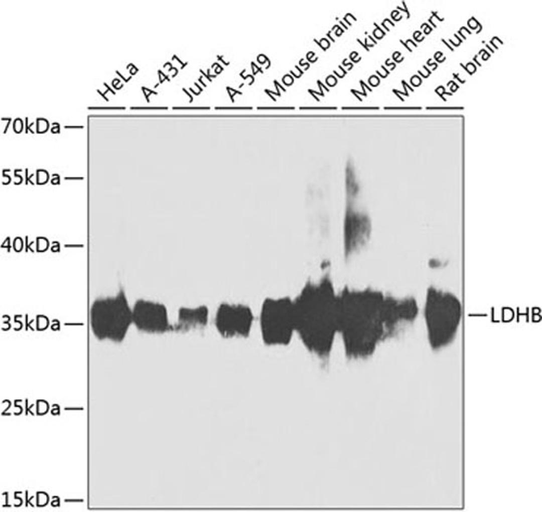 Western blot - LDHB antibody (A7625)