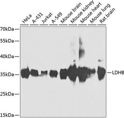 Western blot - LDHB antibody (A7625)