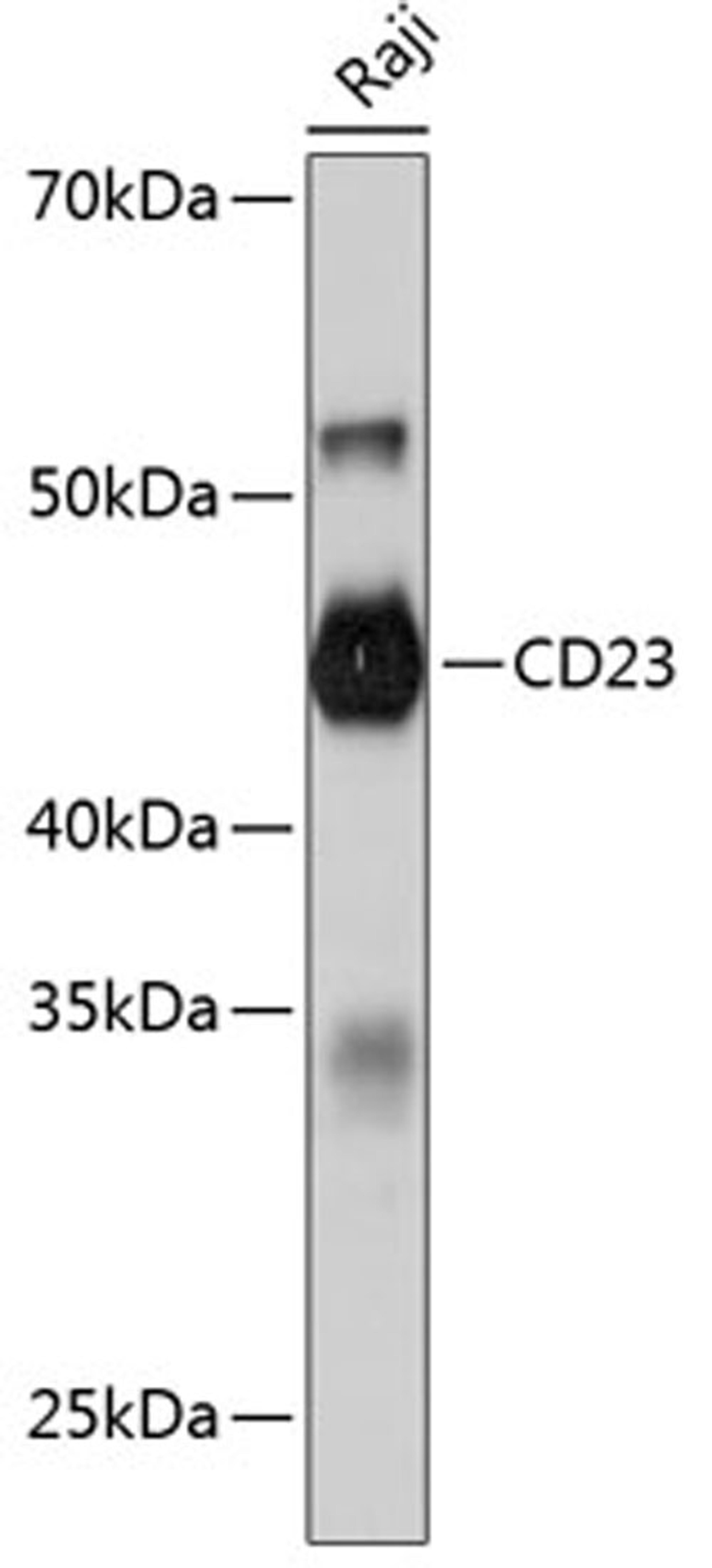 Western blot - CD23 Rabbit mAb (A11436)