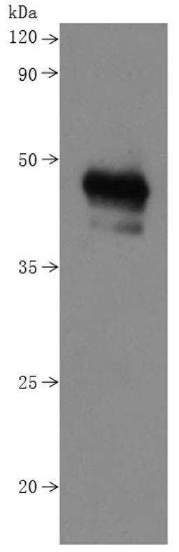 CSB-MP015007HU is detected by Mouse anti-6*His monoclonal antibody.