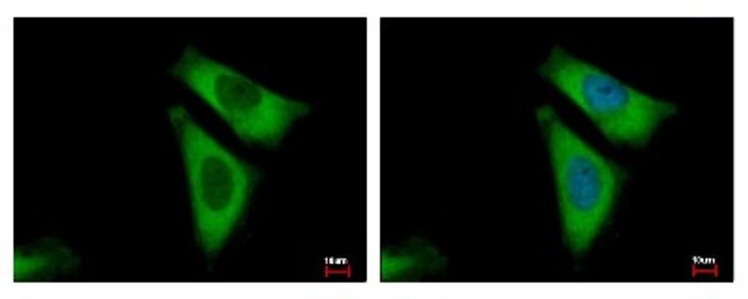 Immunocytochemistry/Immunofluorescence: RPL29 Antibody [NBP2-15103] - Sample: HeLa cells were fixed in 4% paraformaldehyde at RT for 15 min. Green: RPL29 protein stained by RPL29 antibody diluted at 1:500. Blue: Hoechst 33343 staining.