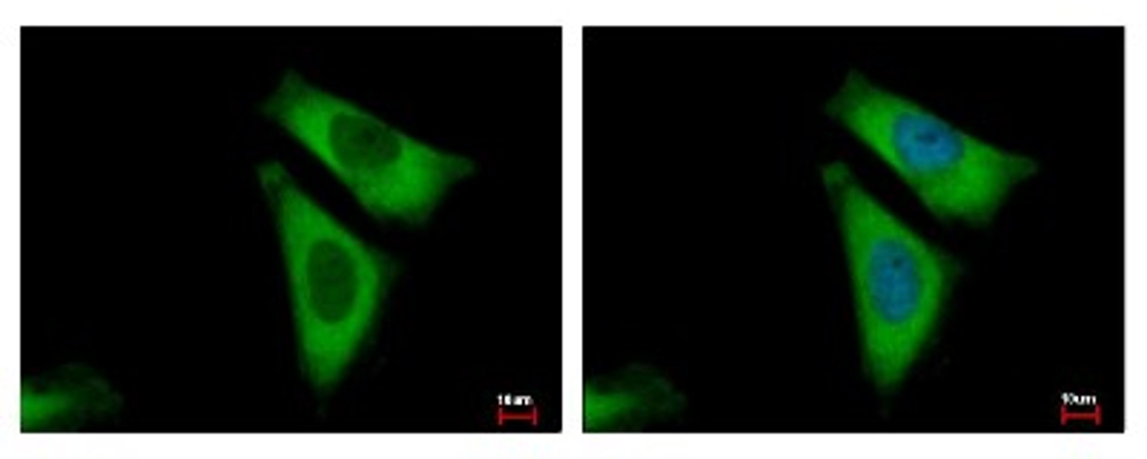 Immunocytochemistry/Immunofluorescence: RPL29 Antibody [NBP2-15103] - Sample: HeLa cells were fixed in 4% paraformaldehyde at RT for 15 min. Green: RPL29 protein stained by RPL29 antibody diluted at 1:500. Blue: Hoechst 33343 staining.